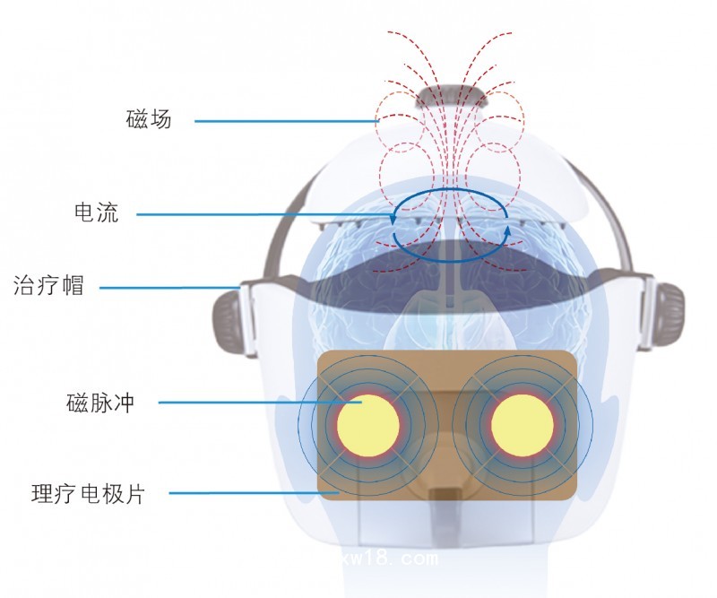 脑循环功能障碍治疗仪